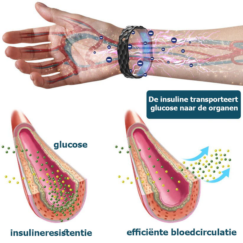 SugarTech™ | Armband zur Blutzuckerregulierung