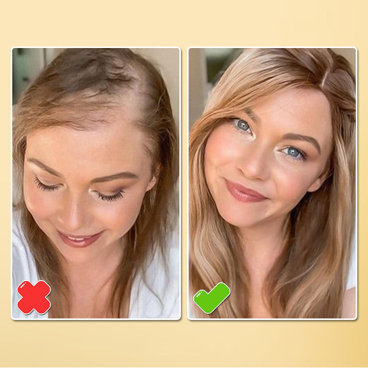 BioHair™ | Biotin Haarwuchs-Essenzspray!