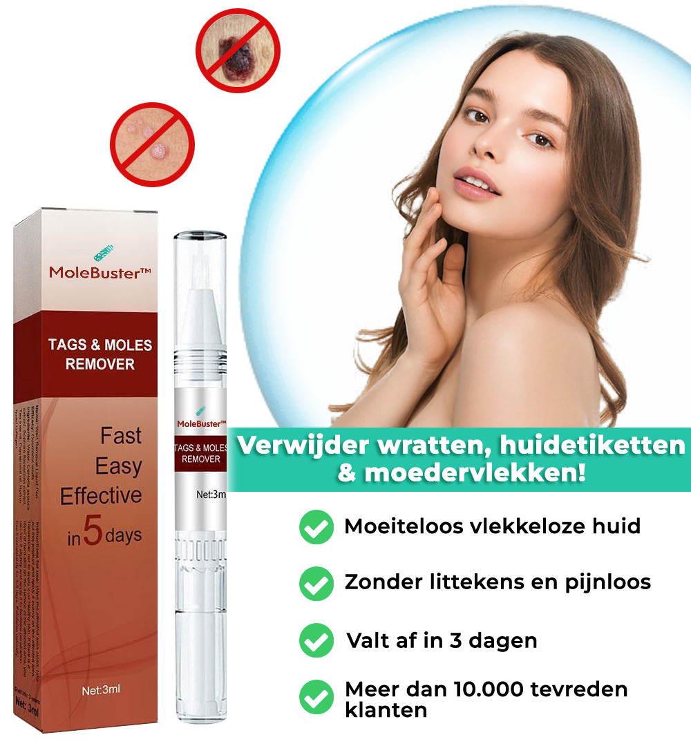 MoleBuster™ | Verwijderaar van Huidetiketten & Moedervlekken