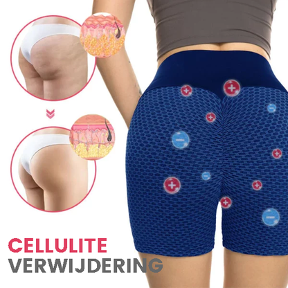 ShapeTrim™ | Afslankende en Vormgevende Short