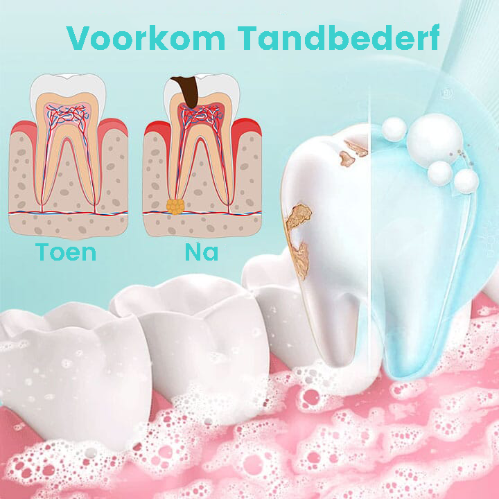 RadiantTeeth™ | Ein Verlust für alle Weltprobleme in einem Spray! 