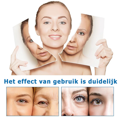 InfiniYouth™ | Botox Gezichtsserum