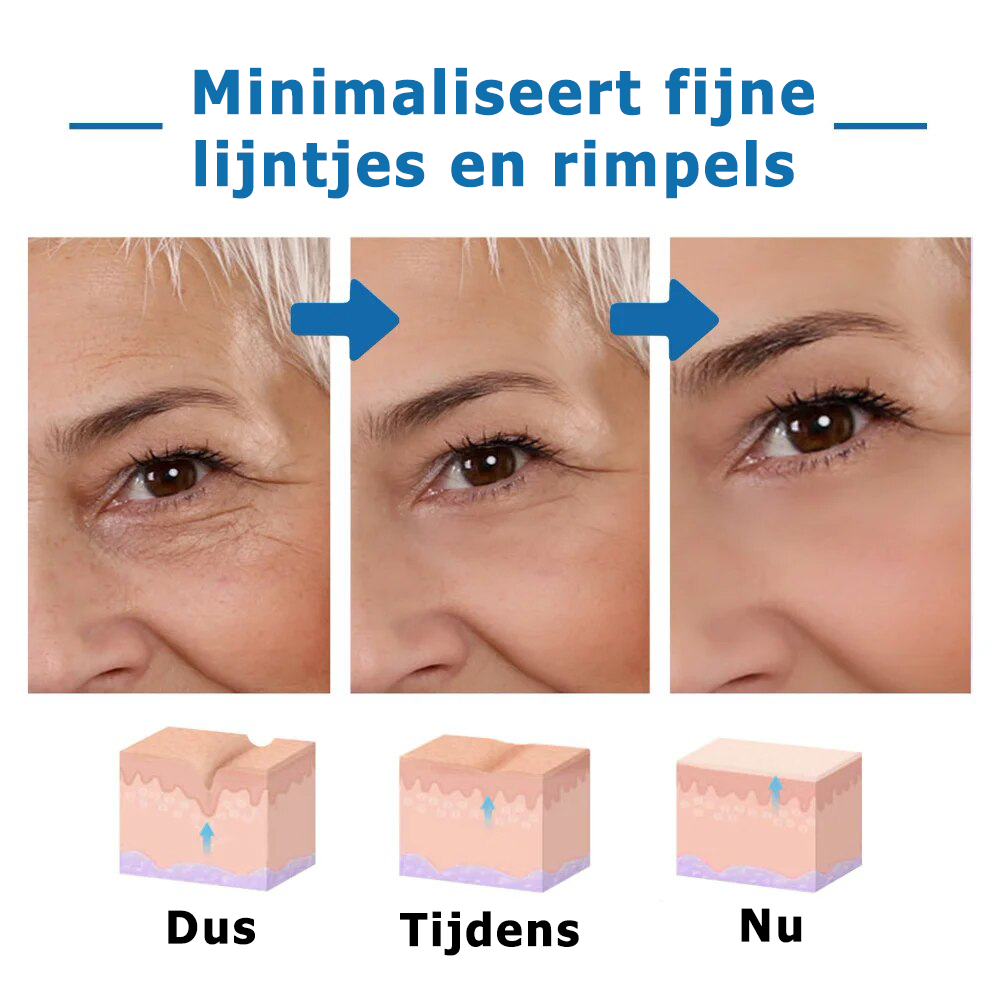 InfiniYouth™ | Botox Gezichtsserum