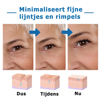 InfiniYouth™ | Botox Gezichtsserum