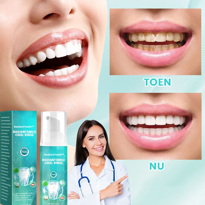 RadiantTeeth™ | Ein Verlust für alle Weltprobleme in einem Spray! 