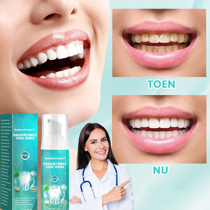 RadiantTeeth™ | Ein Verlust für alle Weltprobleme in einem Spray! 